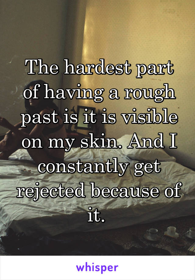 The hardest part of having a rough past is it is visible on my skin. And I constantly get rejected because of it. 