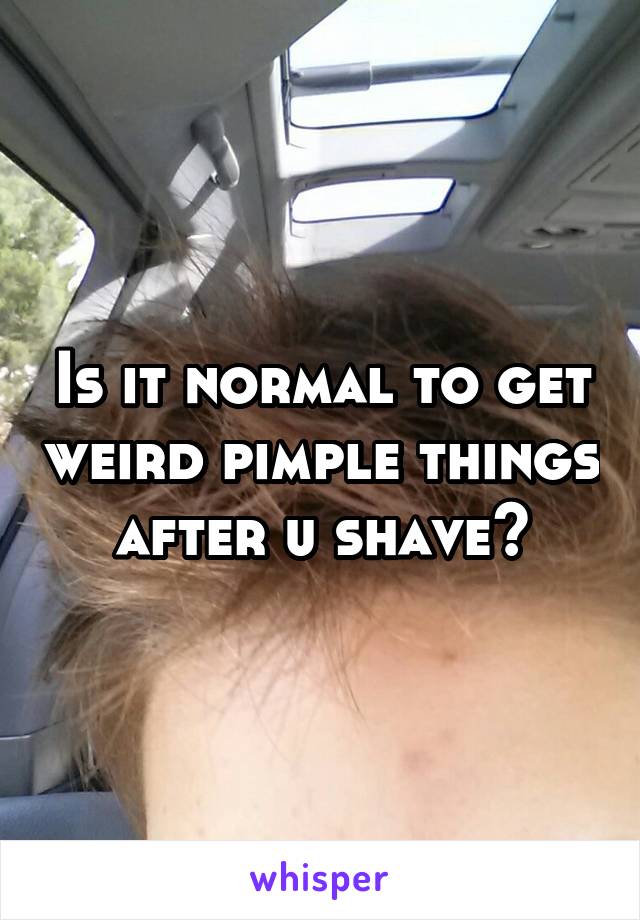 Is it normal to get weird pimple things after u shave?