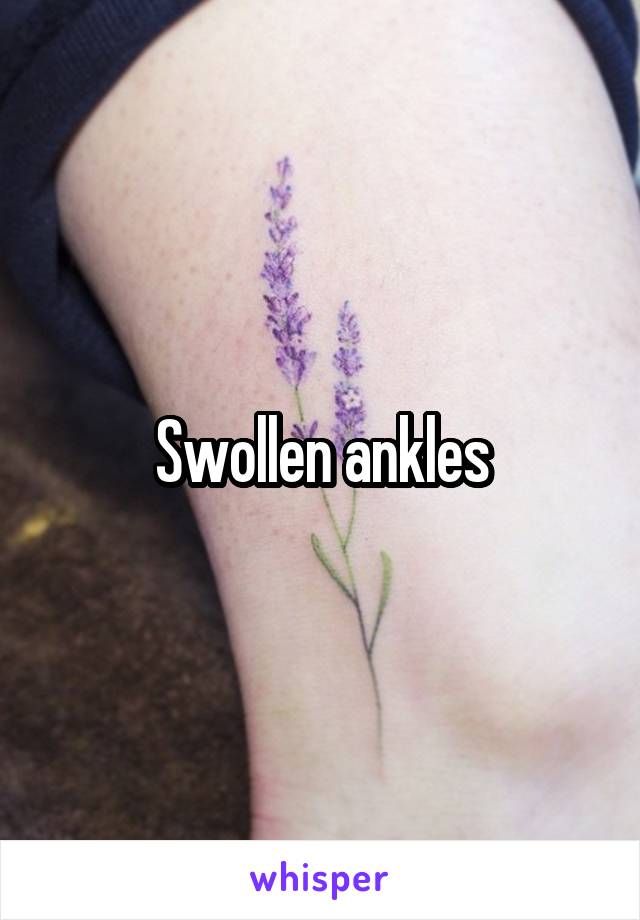 Swollen ankles