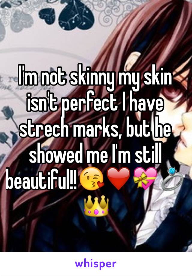 I'm not skinny my skin isn't perfect I have strech marks, but he showed me I'm still beautiful!!😘❤️💝💍👑