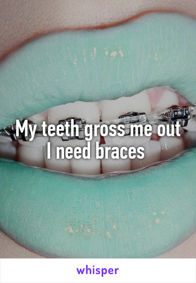 My teeth gross me out I need braces 