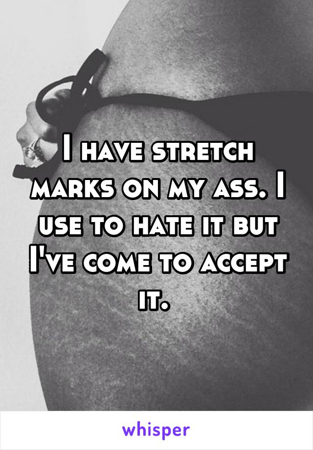 I have stretch marks on my ass. I use to hate it but I've come to accept it. 