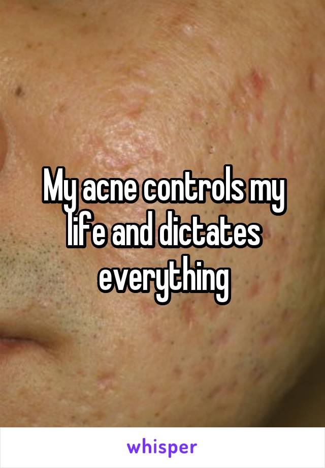 My acne controls my life and dictates everything