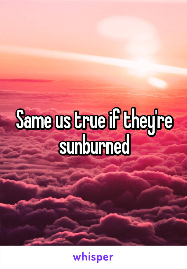 Same us true if they're sunburned