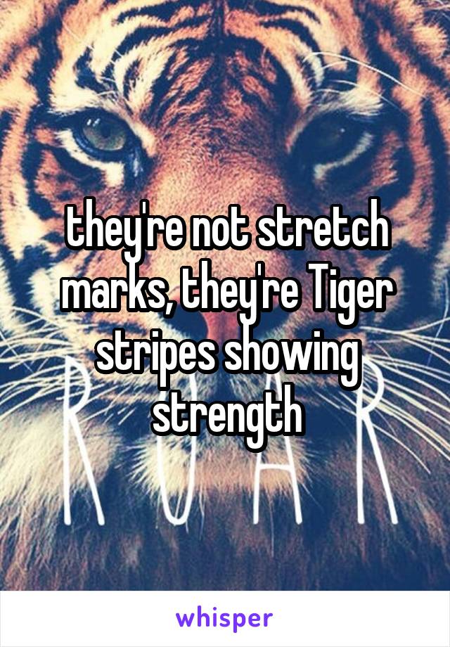 they're not stretch marks, they're Tiger stripes showing strength