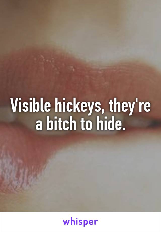 Visible hickeys, they're a bitch to hide.