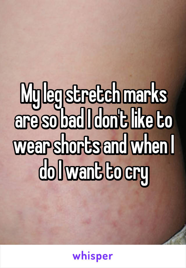 My leg stretch marks are so bad I don't like to wear shorts and when I do I want to cry