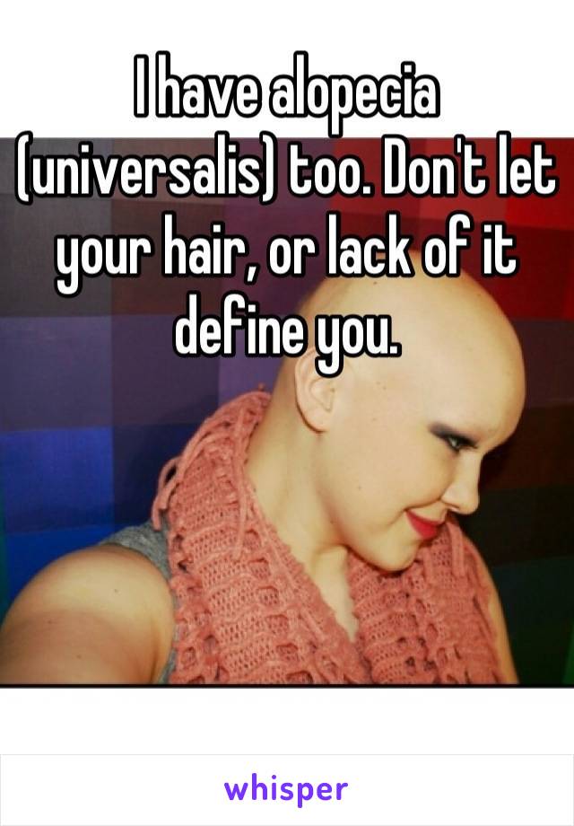 I have alopecia (universalis) too. Don't let your hair, or lack of it define you.