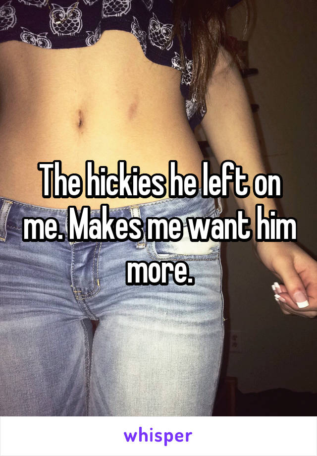 The hickies he left on me. Makes me want him more.