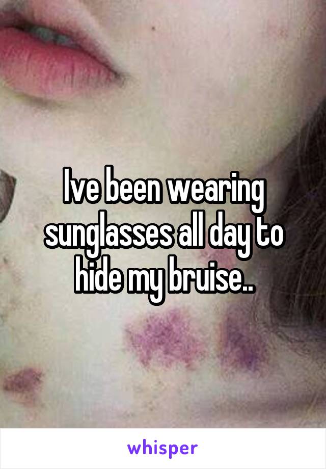 Ive been wearing sunglasses all day to hide my bruise..