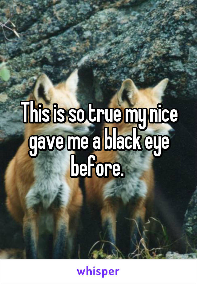 This is so true my nice gave me a black eye before. 