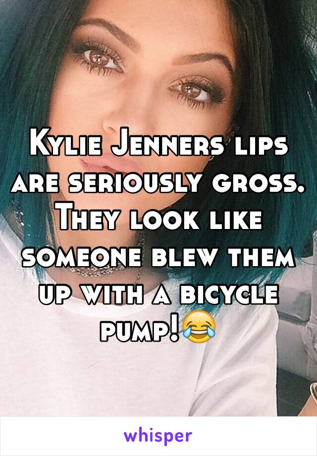 Kylie Jenners lips are seriously gross. They look like someone blew them up with a bicycle pump!😂