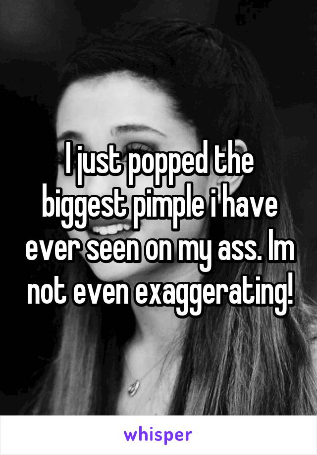 I just popped the biggest pimple i have ever seen on my ass. Im not even exaggerating!