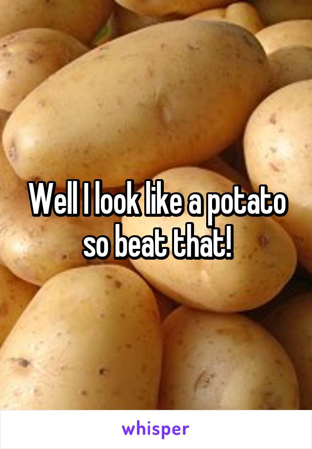 Well I look like a potato so beat that!