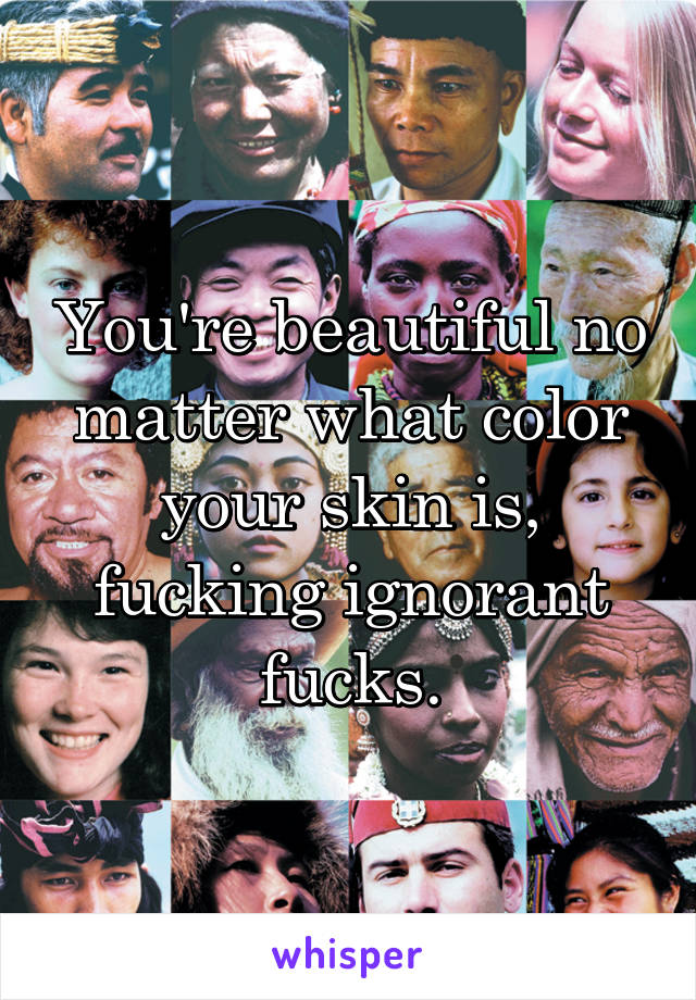 You're beautiful no matter what color your skin is, fucking ignorant fucks.