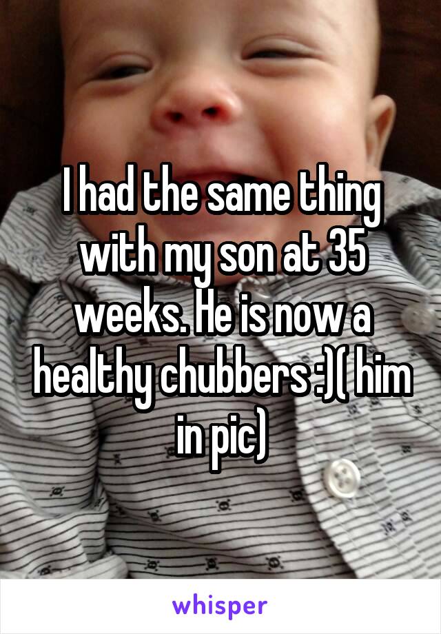 I had the same thing with my son at 35 weeks. He is now a healthy chubbers :)( him in pic)