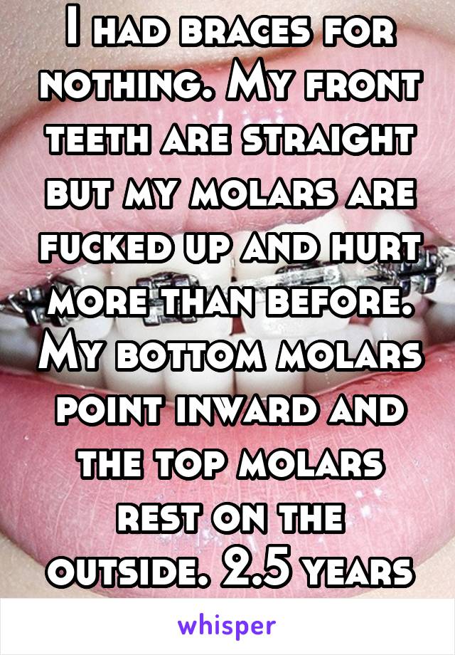 I had braces for nothing. My front teeth are straight but my molars are fucked up and hurt more than before. My bottom molars point inward and the top molars rest on the outside. 2.5 years wasted. 