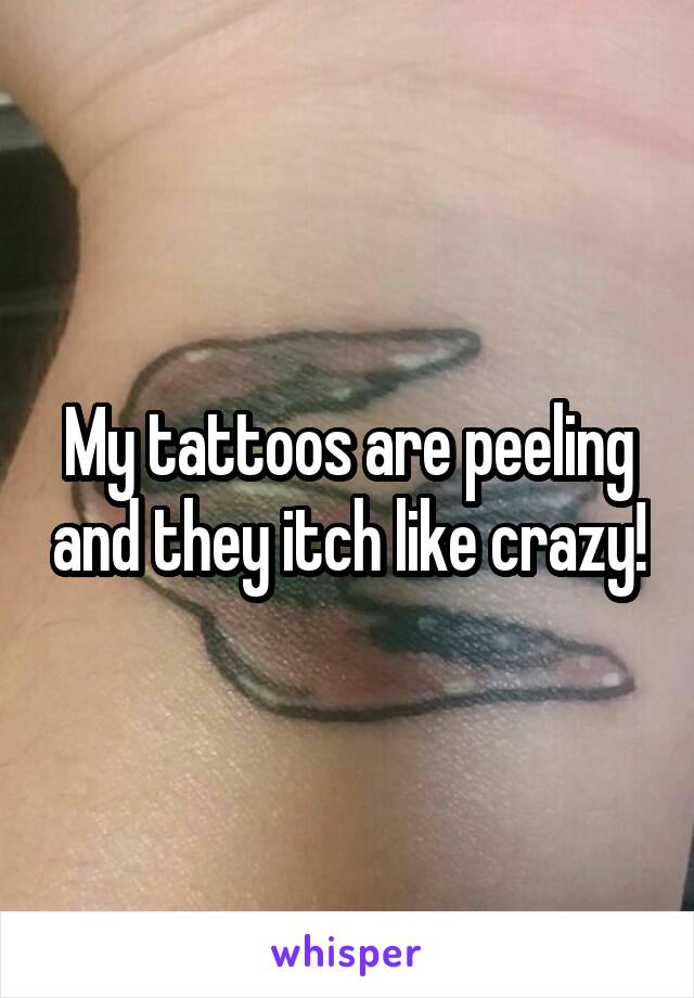 My tattoos are peeling and they itch like crazy!