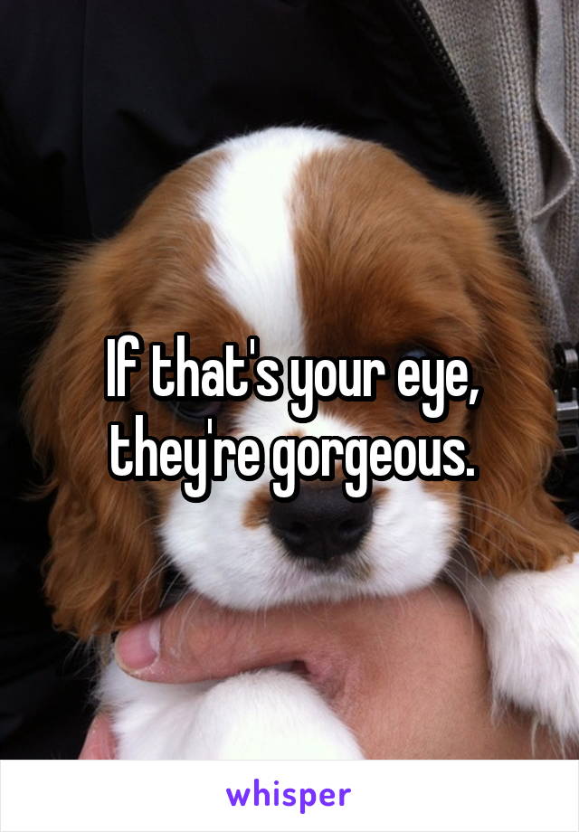If that's your eye, they're gorgeous.
