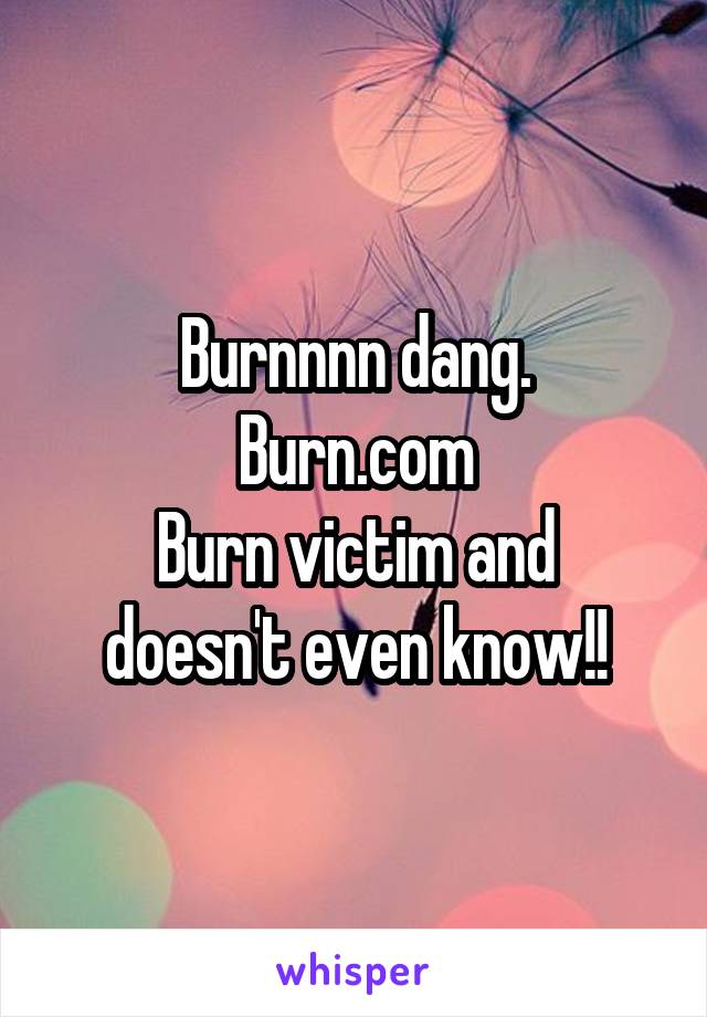 Burnnnn dang.
Burn.com
Burn victim and doesn't even know!!