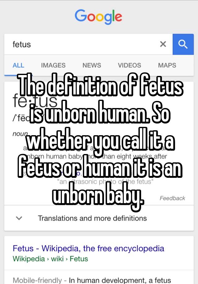 the-definition-of-fetus-is-unborn-human-so-whether-you-call-it-a-fetus-or-human-it-is-an-unborn