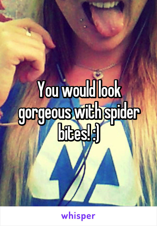 You would look gorgeous with spider bites! :)