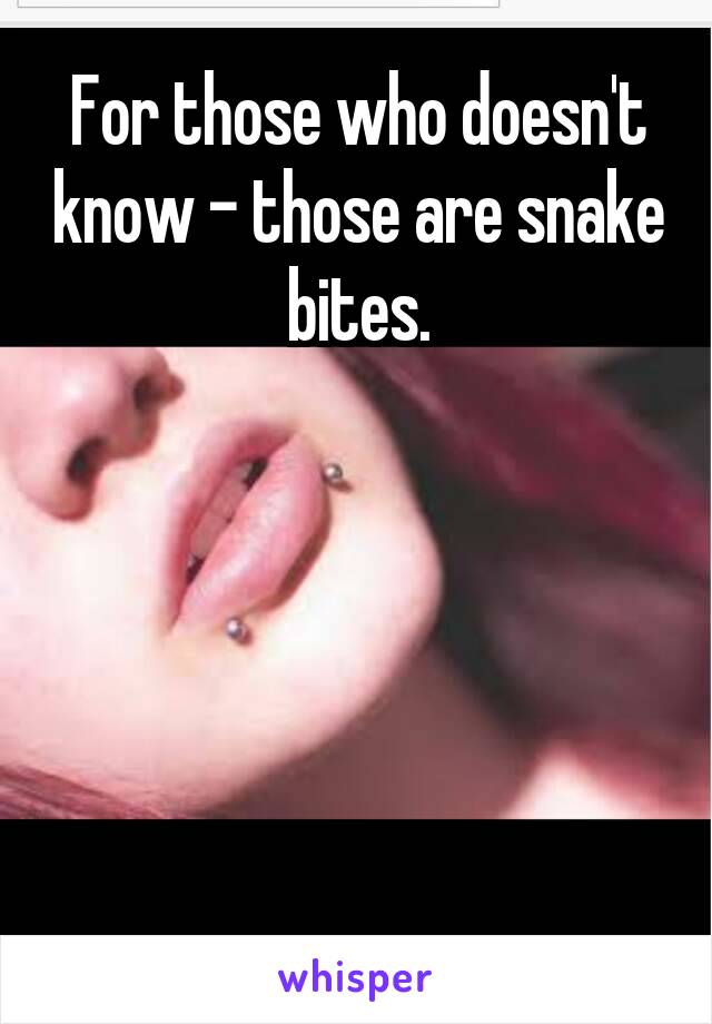 For those who doesn't know - those are snake bites.





