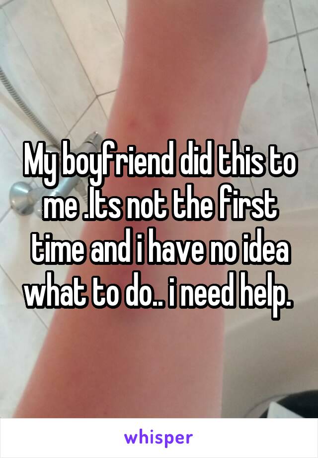 My boyfriend did this to me .Its not the first time and i have no idea what to do.. i need help. 