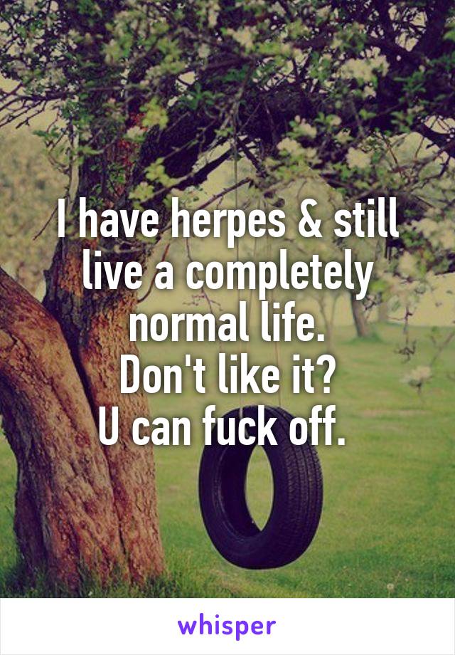I have herpes & still live a completely normal life.
Don't like it?
U can fuck off. 