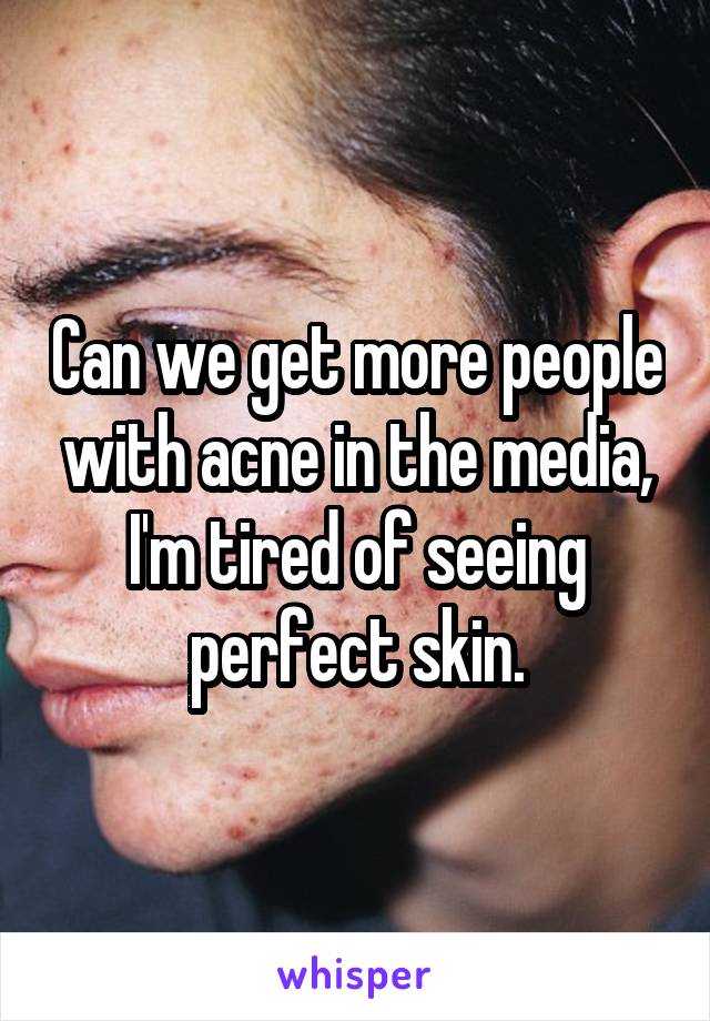 Can we get more people with acne in the media, I'm tired of seeing perfect skin.