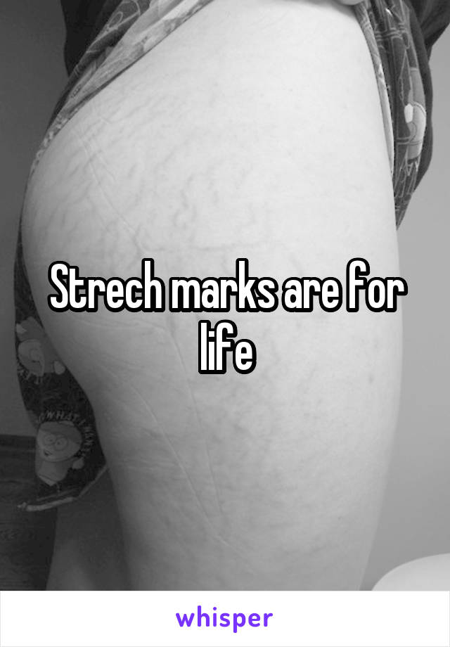 Strech marks are for life