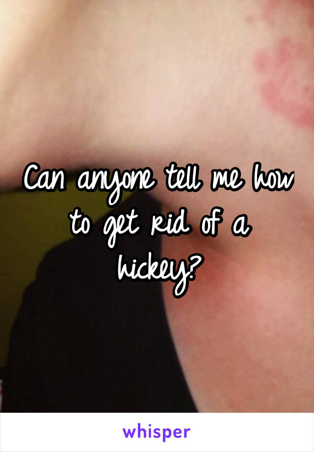 Can anyone tell me how to get rid of a hickey?