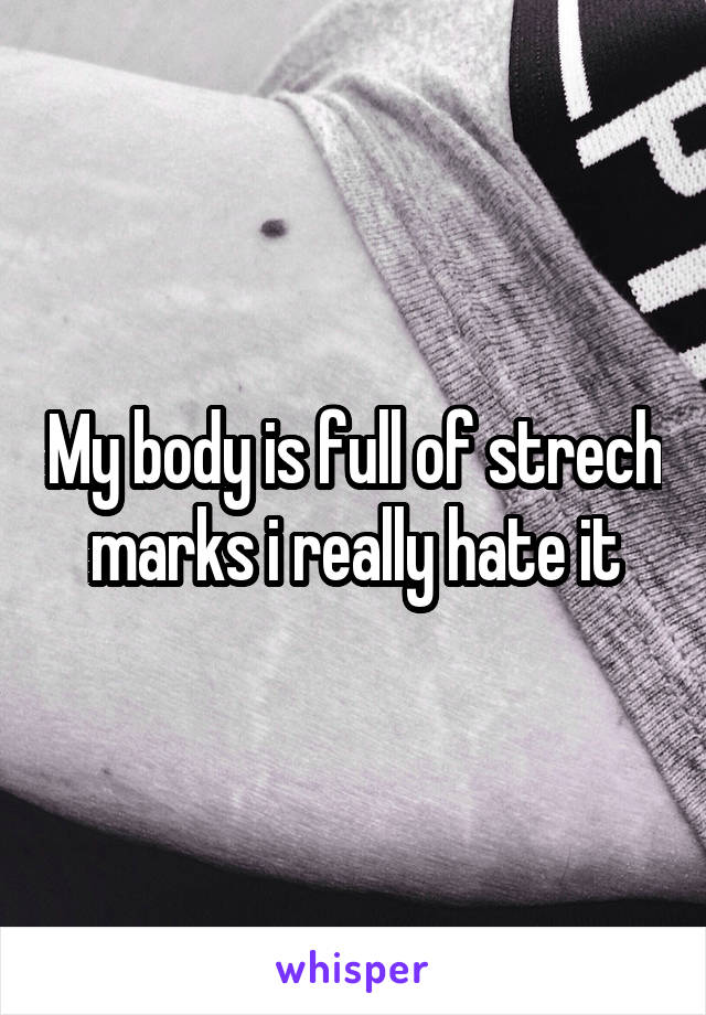 My body is full of strech marks i really hate it