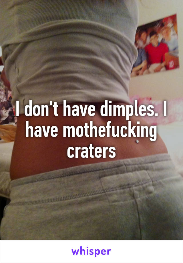 I don't have dimples. I have mothefucking craters