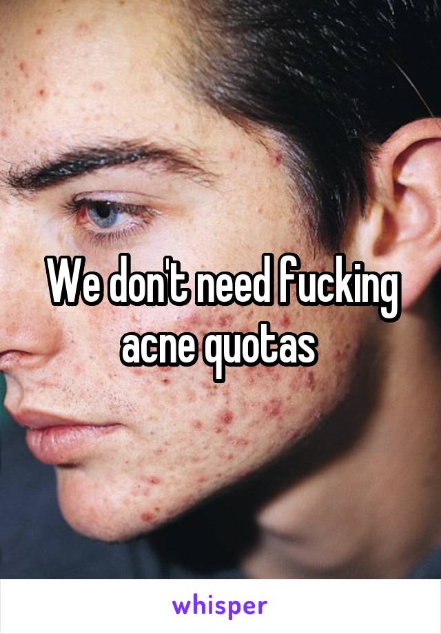 We don't need fucking acne quotas 