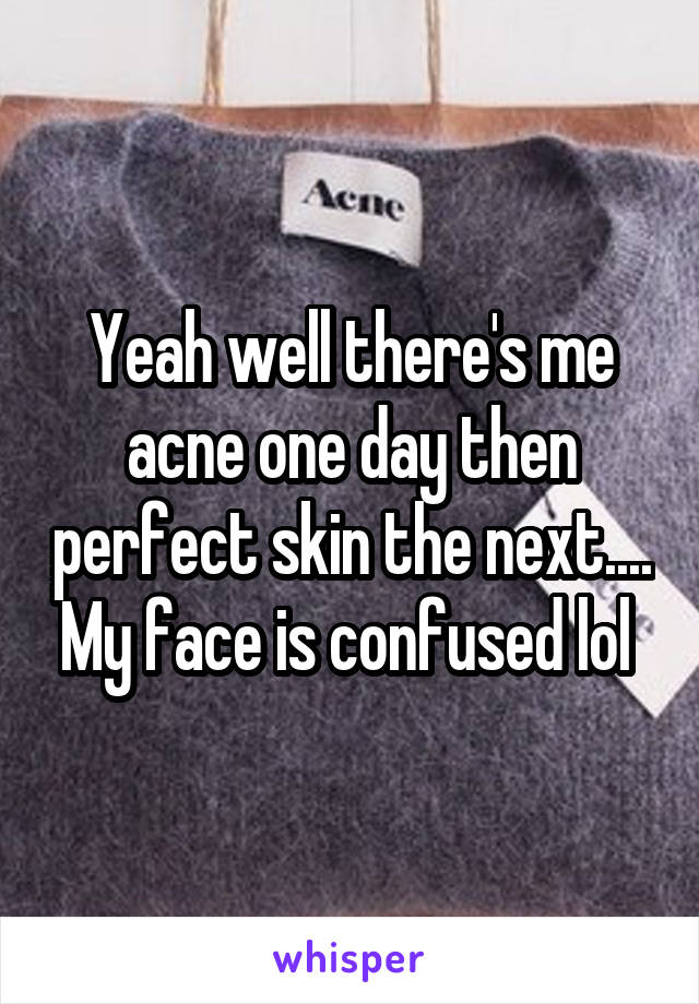 Yeah well there's me acne one day then perfect skin the next.... My face is confused lol 
