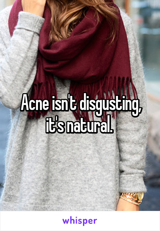 Acne isn't disgusting, it's natural. 