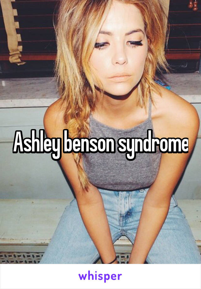 Ashley benson syndrome