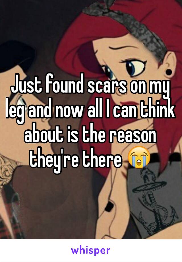 Just found scars on my leg and now all I can think about is the reason they're there 😭