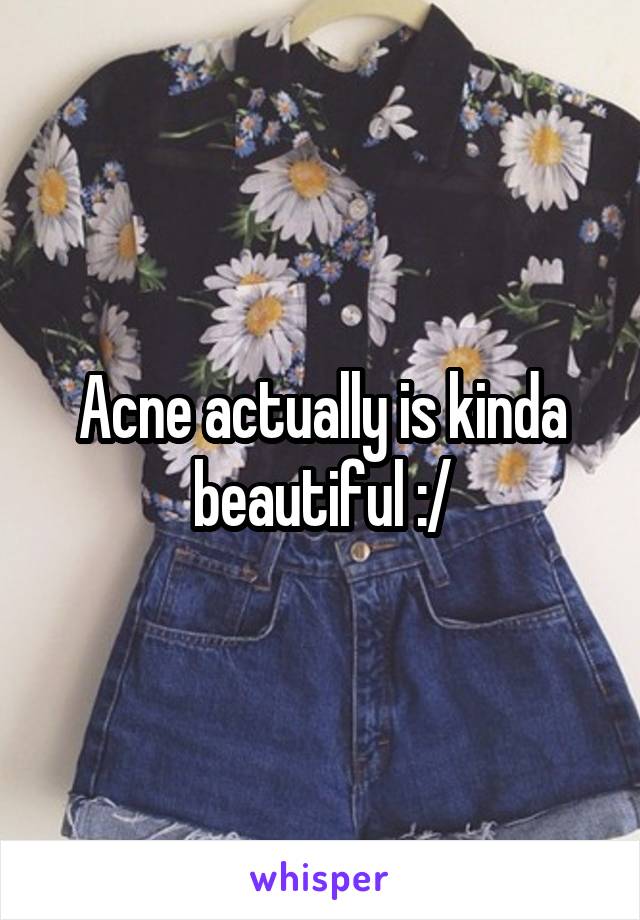 Acne actually is kinda beautiful :/