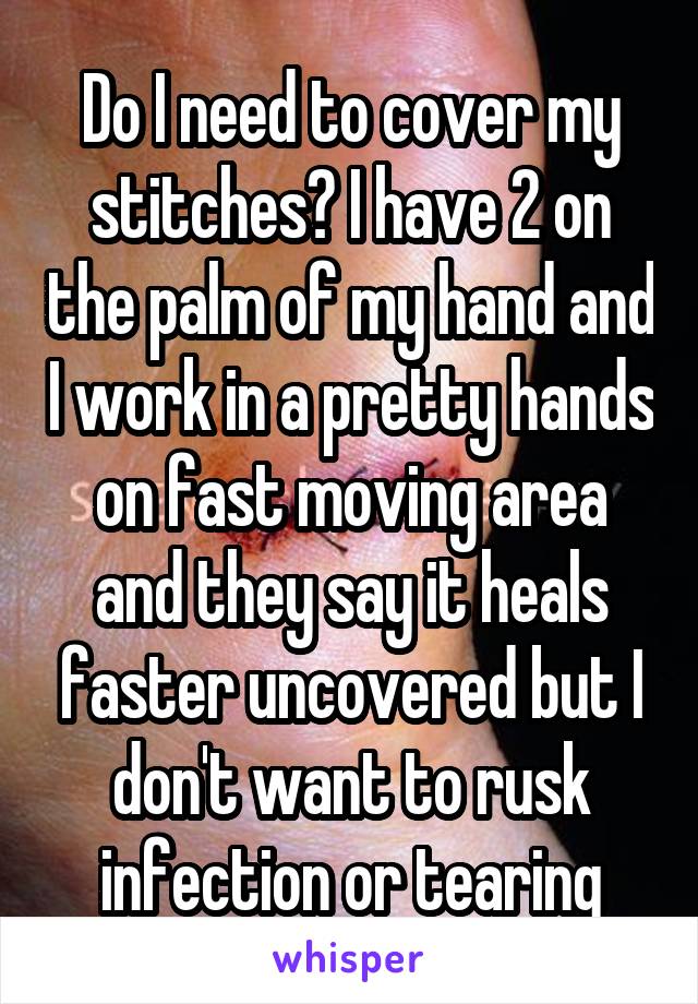 Do I need to cover my stitches? I have 2 on the palm of my hand and I work in a pretty hands on fast moving area and they say it heals faster uncovered but I don't want to rusk infection or tearing