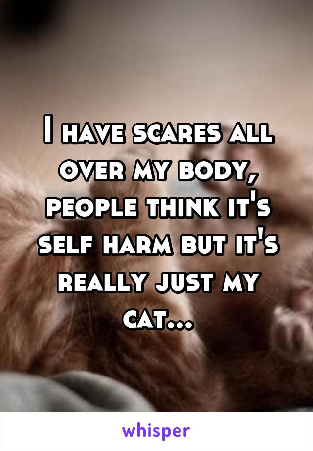 I have scares all over my body, people think it's self harm but it's really just my cat...