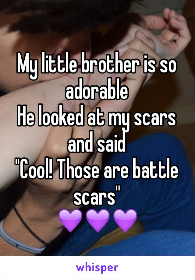 My little brother is so adorable 
He looked at my scars and said 
"Cool! Those are battle scars"
💜💜💜