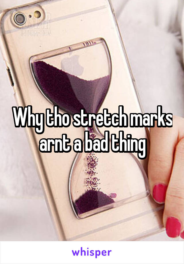 Why tho stretch marks arnt a bad thing