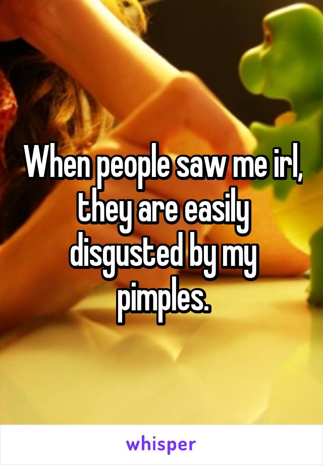 When people saw me irl, they are easily disgusted by my pimples.