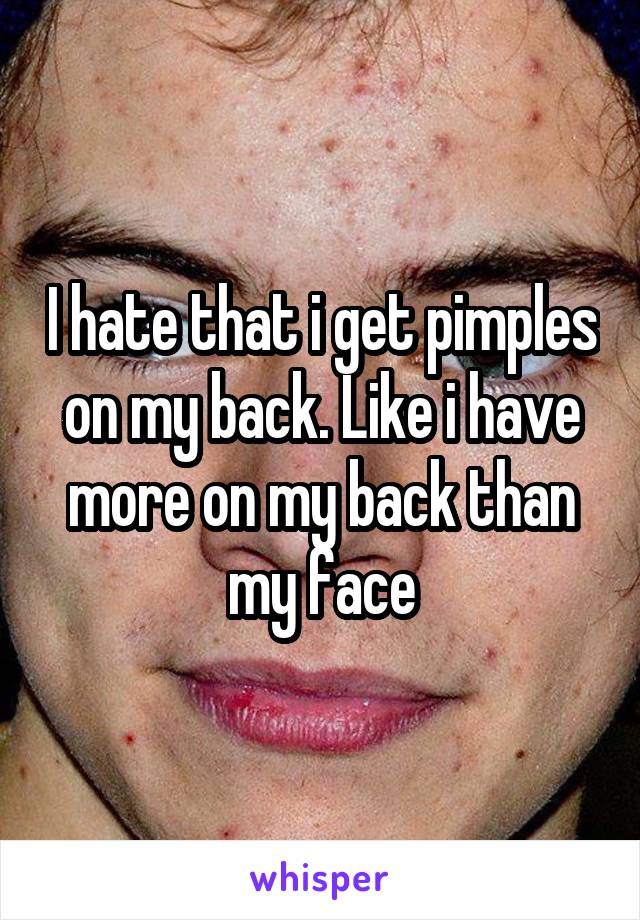 I hate that i get pimples on my back. Like i have more on my back than my face
