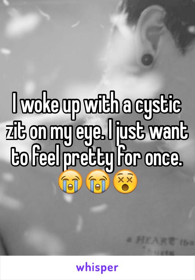 I woke up with a cystic zit on my eye. I just want to feel pretty for once. 😭😭😵