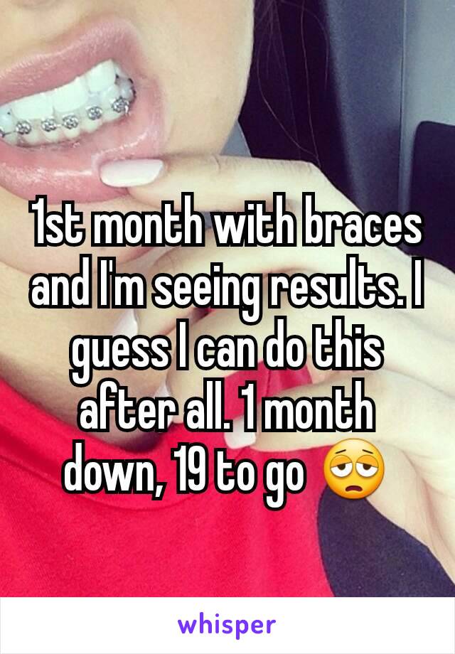 1st month with braces and I'm seeing results. I guess I can do this after all. 1 month down, 19 to go 😩