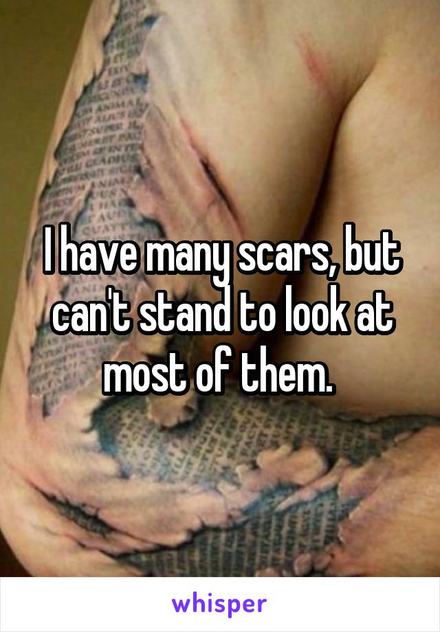 I have many scars, but can't stand to look at most of them. 