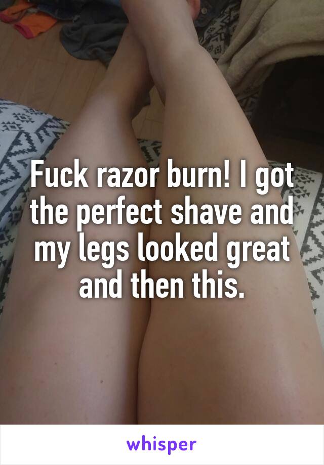 Fuck razor burn! I got the perfect shave and my legs looked great and then this.